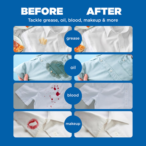 Ecover Stain Remover 200ml